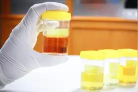 女人晨起的“第一泡尿”，若没有4个现象，说明你的子宫还算健康图片