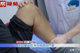 一男子日常运动量过大，结果腿部变形了图片