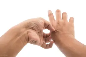 手上长“小水泡”，痒痒痒！能根治吗？4种常见药物如何使用？图片