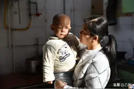 人间最悲惨的宝贝：出生患肝硬化，一个月四次开腹，左眼球被摘除图片