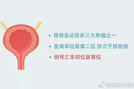 科学抗癌 防治有策 | 张雪培教授：在“沉默”中悄然发生的肾癌，该如何预防？图片
