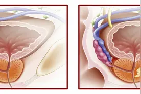 男性体内有一个特有的性腺器官——前列腺，个子小作用大注意保护图片