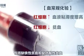 干货！2分钟教你看体检报告图片