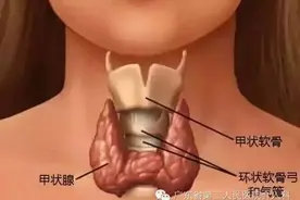 如何无痕处理甲状腺结节？图片