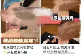 鼓吹“精灵耳”，整容圈都开始内卷了吗？图片