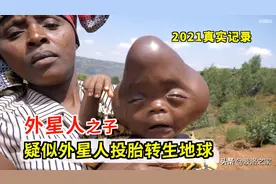 疑似外星人投胎转生地球，2021年出生的“外星人之子”，真实记录图片