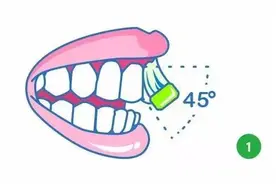 晚上不刷牙，是对牙齿最大的“虐待”图片
