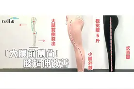 打造女团腿：正确瘦大腿前侧突&膝超伸矫正动作图片