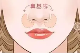 侧面不够立体？可能是鼻基底的问题！图片