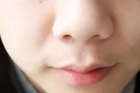 用手一挤，鼻子上就会出现白色的条状物，是什么？图片