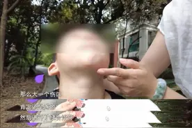 教育新视听丨幼儿园卫生间摔倒三次，最后一次留疤，家长索要祛疤费遇困难……图片