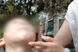 教育新视听丨幼儿园卫生间摔倒三次，最后一次留疤，家长索要祛疤费遇困难……图片
