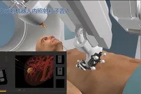 中大医院介入治疗肿瘤又有新进展 全球首创多脏器肿瘤粒子介入机器人有望服务病人图片