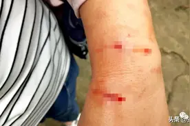 藏獒突然发疯！狂吠不止，咬伤主人，特警一枪击毙图片