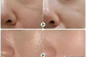 打完水光针，闺蜜都说我的皮肤有“韩国女明星内味儿”图片
