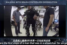 人兽杂交器官移植？这些研究有些科幻图片