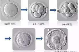 囊胚培养和移植适合哪些人群呢？图片