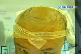 从“免费植发”到背上三万九千元贷款，一共分几步？图片