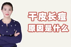 为什么脸很干还长痘，干皮长痘痘是怎么回事？视频封面