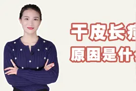 为什么脸很干还长痘，干皮长痘痘是怎么回事？视频封面