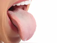 身体好不好，舌头先报告？舌头出现4种现象，劝你及时做好调理图片