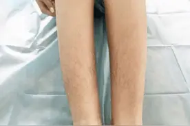 为什么有的女性体毛旺盛，有的“光秃秃”的？是什么原因呢？图片