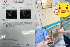 腺肌症治得好吗？孙爱达在东方博大医院图片
