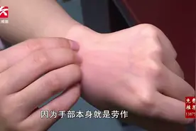 警惕“家庭主妇手”，做家务可戴上手套、消毒前后可涂抹保湿霜视频封面