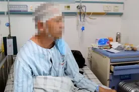 讲话都痛！男子左脸疼痛3个月瘦了10斤，一查颅内长了“白珍珠”图片