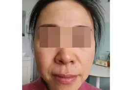 51岁，脸上没了法令纹和皮肤松垂，这才是"中老年少女"的真相图片