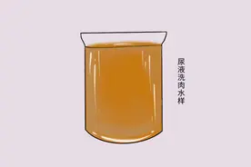 癌症来临时，小便和大便早就提示过？上厕所时，留意两种异常图片