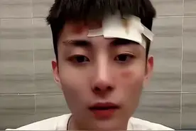 帅气网红自曝出车祸，对方酒驾肇事逃逸，头部腿部受伤流血缠绷带图片