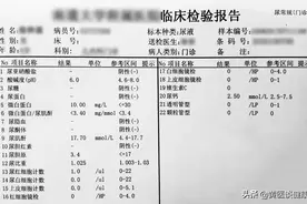 快速看懂尿液检查单图片