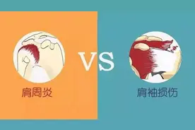 以为是肩周炎，结果却是肩袖损伤，肩袖损伤是怎么回事？图片