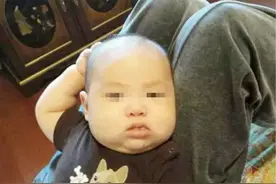 2岁宝宝频繁摸头，洗头也没见缓解，检查后医生说：还好来得及时图片