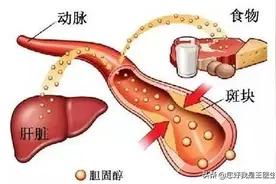 阿托伐他汀，瑞舒伐他汀，这可不能随便吃！图片