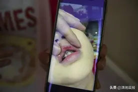长沙5岁男孩因不睡午觉被老师打到嘴巴出血，园方：确拍打了头部视频封面