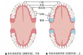 “千万别把智齿一次性拔完”上热搜，原来3种情况下可以保留图片