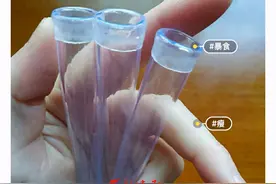为变瘦她们选择极端方式“催吐”，医生：操作不慎或导致消化道出血图片