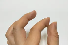 胶水粘住手不用急，教你几招，轻松除掉，简单实用，你也去试试视频封面