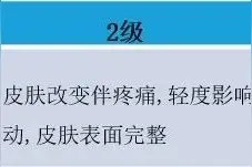 一文掌握 | 手足综合征如何应对图片