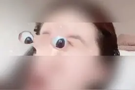 太可怕！模仿视频特效，6岁男孩把自己眼球抠坏了图片