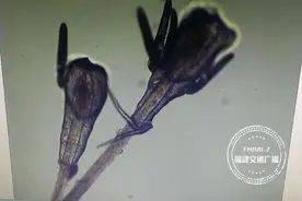 福州一女子狂掉眉毛，一查竟发现是螨虫作祟！医生:要选择正规的医疗机构做项目图片