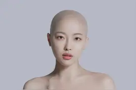 网红因淋巴癌去世，年仅30岁！为抗癌剃光头还在锁骨下置输液管图片