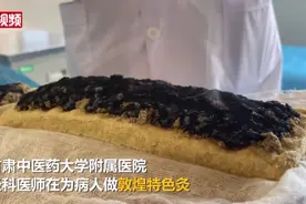 生姜制饼能治病？看看敦煌特色灸是如何做的图片