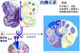 脑干、小脑及间脑解剖图片
