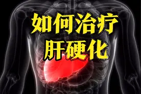 如何治疗肝硬化？3个阶段，医生会有哪些不同的方案？图片