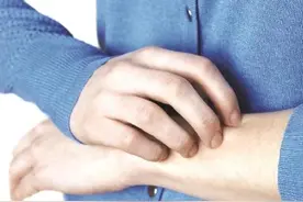 春暖花开，警惕各类皮肤病来袭图片