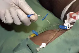 插入患者颈椎的深静脉导管，年轻医师根基不牢的必然图片