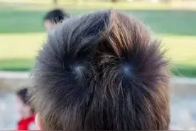 人的头顶为什么会长漩涡？图片